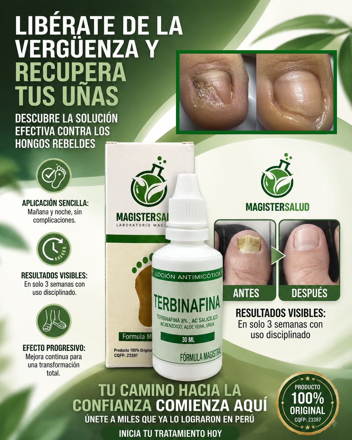 TERBINAFINA 8% (ELIMIINA ELHONGO DESDE LA RAIZ)